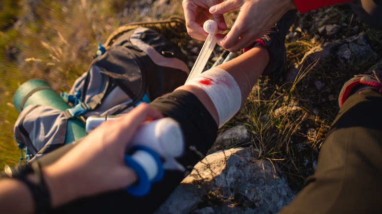 Person performing first aid on another hiker's bleeding shin