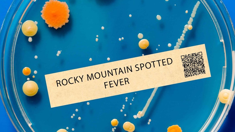 Petri dish of rocky mountain spotted fever bacteria 