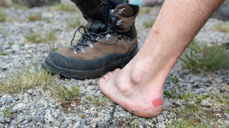 Hiking blister 