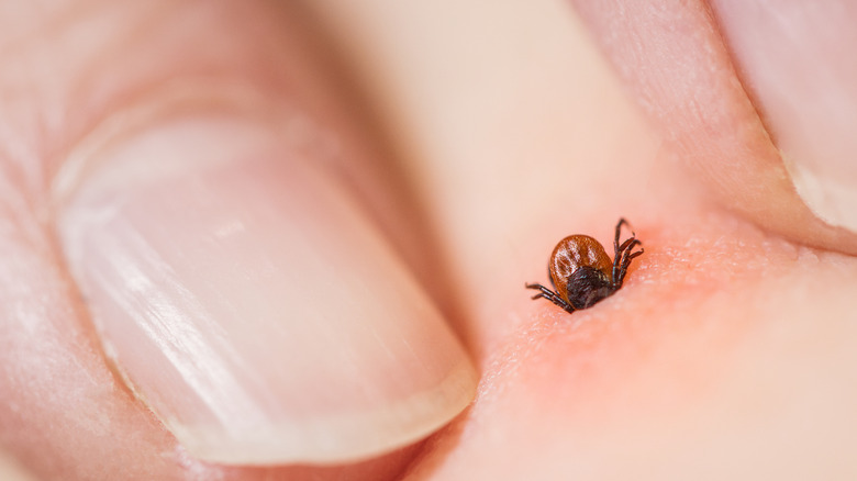 A tick on someone's skin, close up with nails next to it