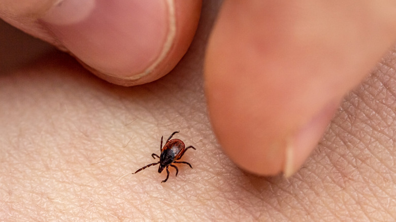 Person trying to grab a tiny tick on skin